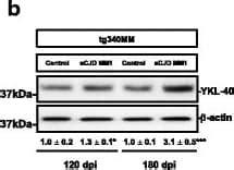 Human Chitinase 3